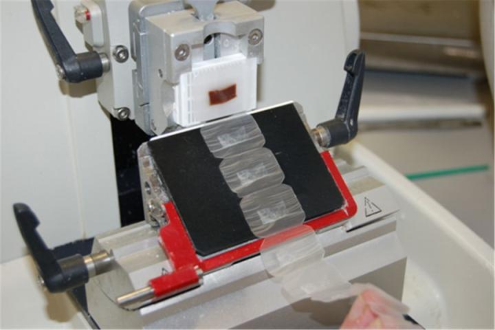 A ribbon of sections being cut from a paraffin block using a rotary microtome. Note that the sections which are 4µm thick (4/1000 of a millimetre), show little distortion or disruption.