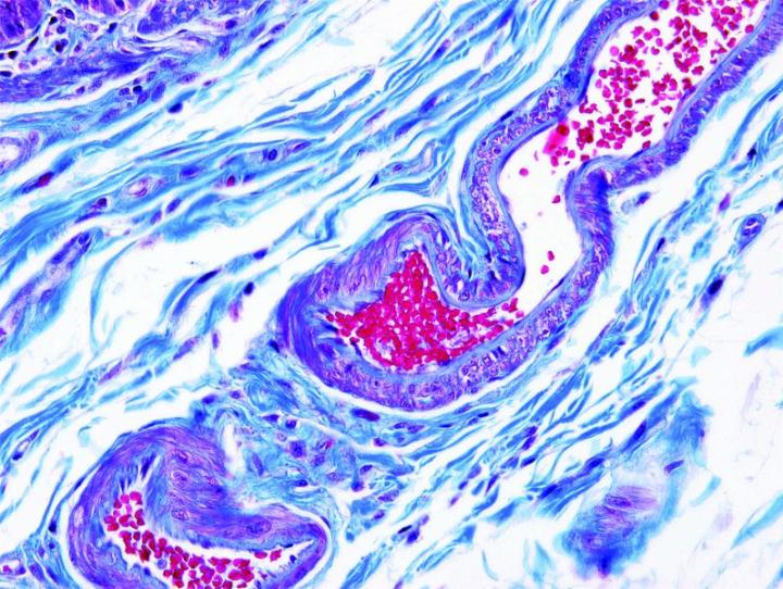Figure 15: Gomori Trichrome (blue) (submucosa). Trichrome stains are used to stain and identify muscle fibers, collagen and nuclei. They can be used to contrast skeletal, cardiac or smooth muscle. The Gomori Trichrome is a simplification of the more elaborate Masson trichrome stain and combines the plasma stain (chromotrope 2R) and connective tissue stain to provide a brilliant contrasting picture. Gomori Trichrome (blue) (submucosa). Trichrome stains are used to stain and identify muscle fibers, collagen and nuclei. They can be used to contrast skeletal, cardiac or smooth muscle. The Gomori Trichrome is a simplification of the more elaborate Masson trichrome stain and combines the plasma stain (chromotrope 2R) and connective tissue stain to provide a brilliant contrasting picture.