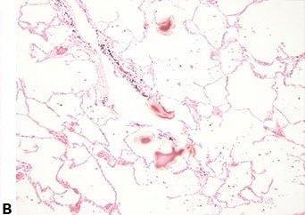 Einführung in die Mikrotomie: Vorbereitung & Schneiden Paraffin-eingebetteter Gewebe