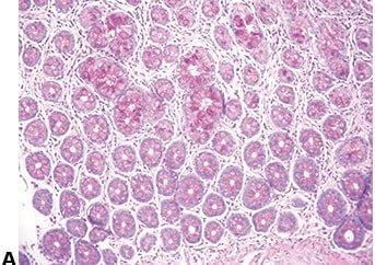 Einführung in die Mikrotomie: Vorbereitung & Schneiden Paraffin-eingebetteter Gewebe