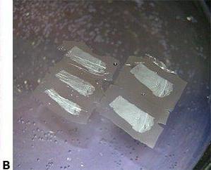 Sử dụng khối lạnh