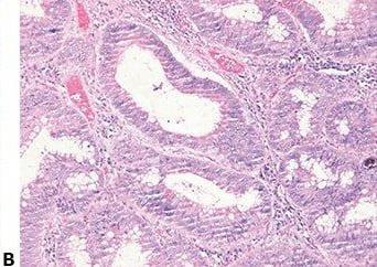 Einführung in die Mikrotomie: Vorbereitung & Schneiden Paraffin-eingebetteter Gewebe