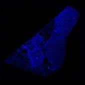 DAPI (counterstain) DAPI (counterstain)