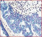2-plex Red and Brown IHC with crystal light green counterstain 2-plex Red and Brown IHC with crystal light green counterstain 2-plex Red and Green RNA ISH with hematoxylin counterstain 2-plex Red and Brown IHC with crystal light green counterstain 2-plex Red and Brown IHC with crystal light green counterstain 2-plex Red and Green RNA ISH with hematoxylin counterstain