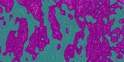 Breast Tissue Breast Tissue