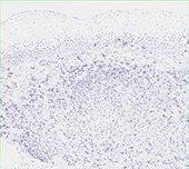 Hematoxylin Counterstain Hematoxylin Counterstain