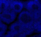 DAPI (Counterstain) DAPI (Counterstain)