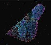 Ultivue PD-L1 kit staining human lung, 4-plex plus DAPI (The protocol was carried out on the BOND RX stainer from Leica Biosystems fully automated stainer and the stained tissue imaged on the Aperio VERSA whole slide scanning system) Ultivue PD-L1 kit staining human lung, 4-plex plus DAPI (The protocol was carried out on the BOND RX stainer from Leica Biosystems fully automated stainer and the stained tissue imaged on the Aperio VERSA whole slide scanning system)