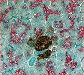 2-plex Red and Brown IHC with crystal light green counterstain