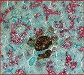 2-plex Red and Brown IHC with crystal light green counterstain 2-plex Red and Brown IHC with crystal light green counterstain