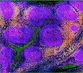 (This is the battle field) Human tonsil, 4-plex assay Immunology panel on tonsil