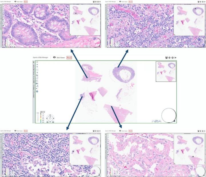 Digital-Pathology