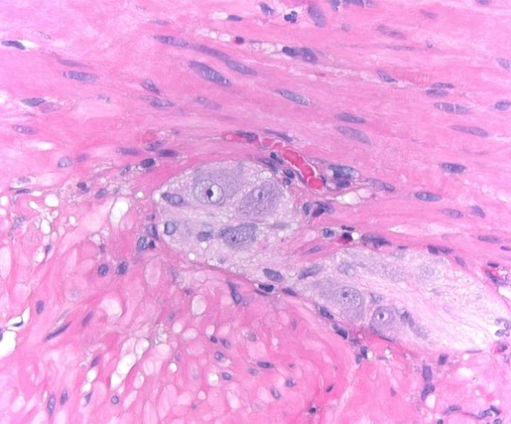 This autonomic ganglion from the myenteric plexus, located between the smooth muscle layers of the muscularis externa of the small intestine, contains ganglionic nurones that show well-defined basophilic Nissl substance (aggregations of endoplasmic reticu