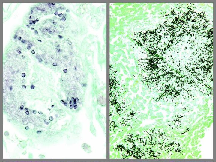 The Modified GMS Silver Stain Kit is intended for use in histological observation of fungi, basement membrane and some opportunistic organisms such as pneumocystis carinii in tissue specimens.