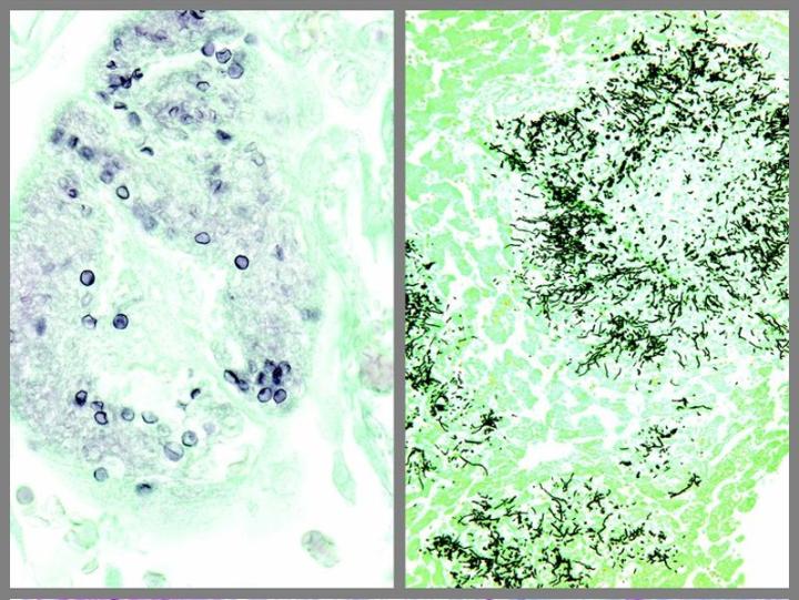 The Modified GMS Silver Stain Kit is intended for use in histological observation of fungi, basement membrane and some opportunistic organisms such as pneumocystis carinii in tissue specimens.