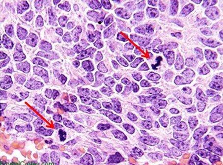 H-and-E-Staining-Overview-A-Guide-to-Best-Practice