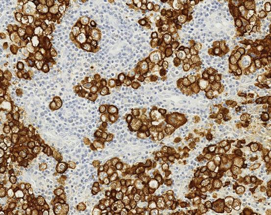 Leica Biosystems introduces the Novocastra HD menu for dermatopathology, the third portfolio of antibodies for IHC in the new Novocastra HD range.
