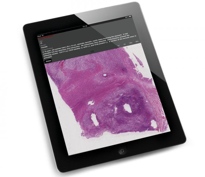 DP_ipad_PR