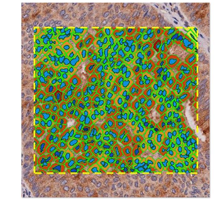 Main Image Cytoplasmic-analysis