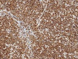 Leica Biosystems launches independently* qualified menu of  IHC antibodies for hematopathology
