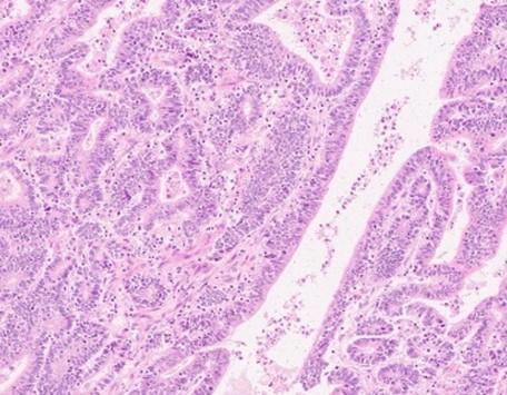 Hematoxylin & Eosin staining, 20X magnification