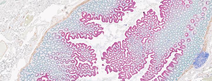 Multiplex Staining 4-Plex