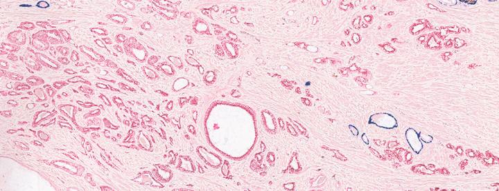 Multiplex Staining 3-Plex