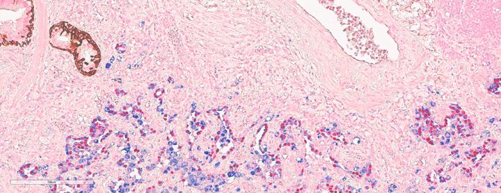 Multiplex Staining 3-Plex