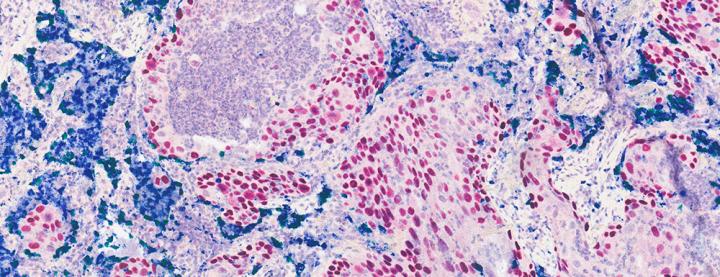 Multiplex Staining 3-Plex