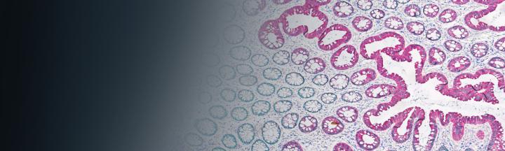 Chromogenic-Multiplexing-Detection-Portfolio-hero-banner Chromogenic-Multiplexing-Detection-Portfolio-hero-banner