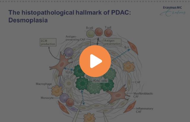 characterization-of-the-pancreatic-tumor-microenvironment-using-novel-quantitative-multiplex-dps-640x410