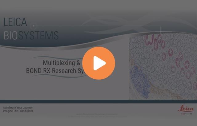 enhanced-automated-multiplex-capabilities-on-leica-biosystems-bond-640x410