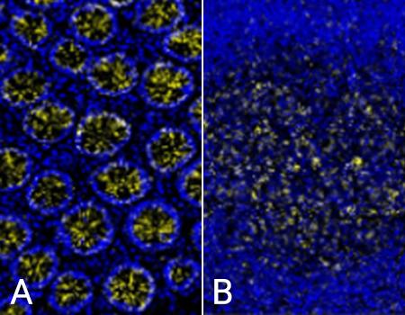 Ecadherin-Beta-catenin-interaction-TMA-NaveniBright-BOND-RX-HRP-450x340-2