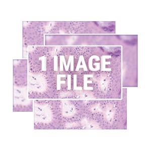 Extended-Focus-1-300x300