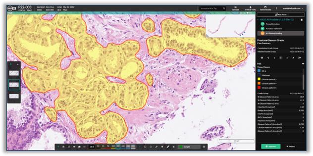 HALO-AP-Prostate-AI-EMEA