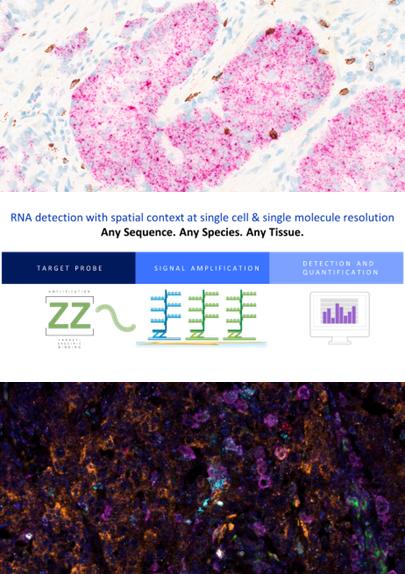 RNAscope-probe-design-ensures-high-specificity-and-Single-Molecule-Sensitivity-405x574