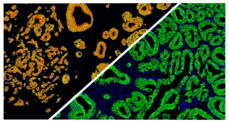 halo-Area-Quantification-FL