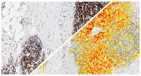 halo-Area-Quantification