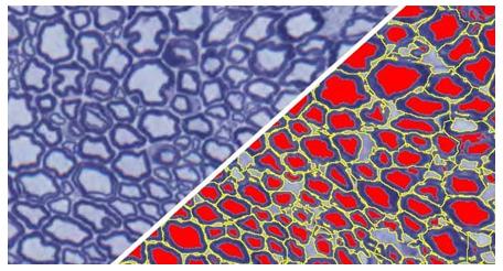 halo-Axon-Quantification