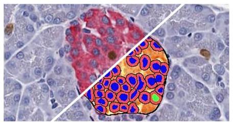 halo-Islet-Quantification