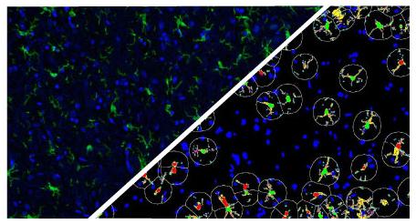 halo-Microglial-Activation-FL