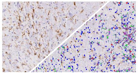halo-Microglial-Activation