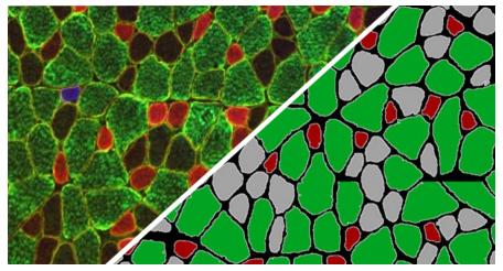 halo-Muscle-Fiber-FL