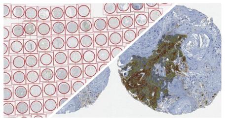 halo-TMA-Tissue-Microarray-Add-On