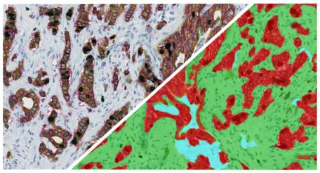 halo-Tissue-Classifier-Add-on