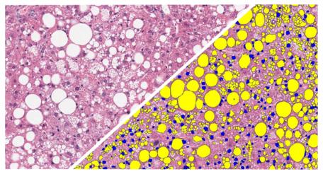 halo-Vacuole-Quantification