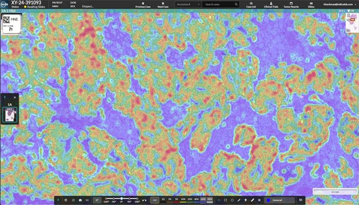 halo-ap-An-AI-Ready-Pathology-Ecosystem​-700x400