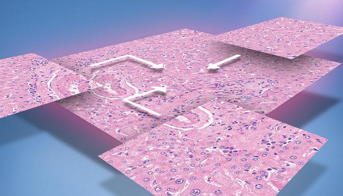Extended-Focus-700x400