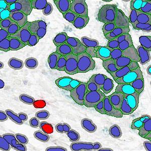Chromogenic Stain Image Analysis of Human Tissue with ChromoPlex III Detection Kit