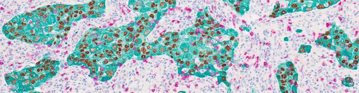 Chromogenic Stain of Human Tissue with ChromoPlex III and BOND RX Chromogenic Stain of Human Tissue with ChromoPlex III and BOND RX
